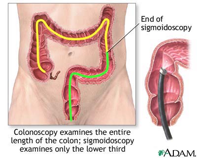 Video examination of the colon