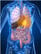 heartburn reflux