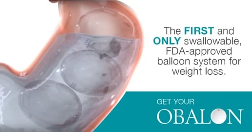 Obalon stomach balloon for obesity