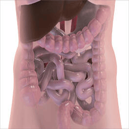 colon colorectal cancer