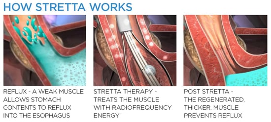 ST_MKT_HowStrettaWorks.jpg