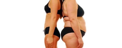 inicisionless-endoscopic-therapy-for-obesity